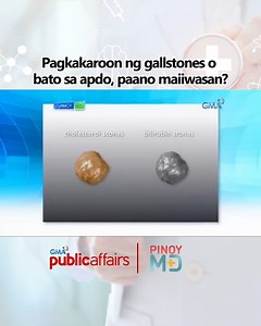 #PinoyMD: Ang labis na pagkain ng mga maaalat at matatabang pagkain ay maaaring maging sanhi ng pagkakaroon ng bato sa apdo o ang tinatawag na gallstones. Paano nga ba ito maiiwasan? Panoorin ang video na ito. | GMA Public Affairs