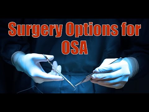 Surgical Procedures and Options for Obstructive Sleep Apnea : Review and Comparison