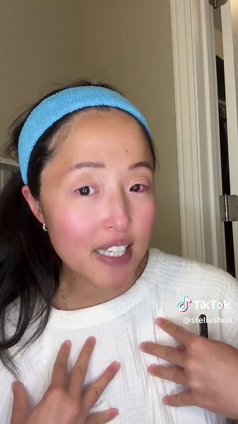 Stella | SJS & Scleral Lens on TikTok