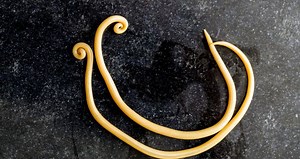 Worms Emerge During Surgery
