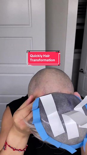 Quickly Achieve Hair Transformation! #lordhair #hairsystem #toupee #toupees #hairstyle #bald #foryou #fyp