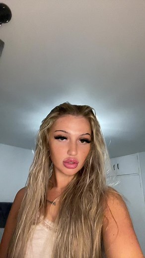 Understanding Lip Swelling Causes and Remedies