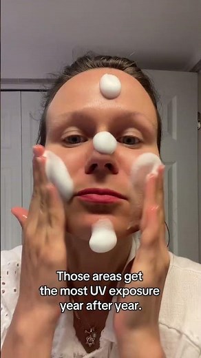 Rosacea on Your Face? The Science Behind Where It Shows Up #rosacea #vitamind