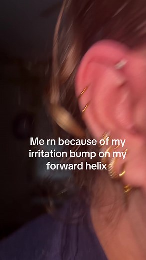Tips to Eliminate Irritation Bumps on Helix Piercings