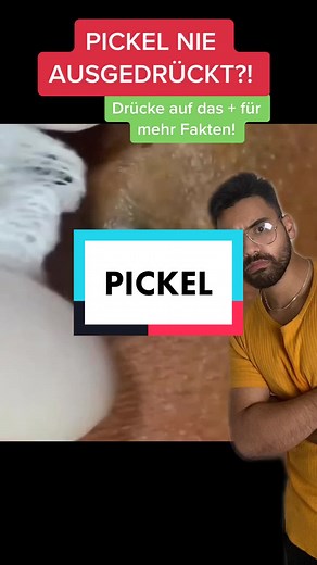 Pickel nie ausgedrückt?! #haut#hautprobleme#pickel#schongewusst#machmit#gesundheit#gesund#krank#helfen#hilfe#reinigen#gygiene#smilesmart#fyp#viral#helfen