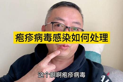 疱疹病毒感染如何处理。