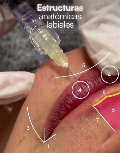 Hermoso Diseño de labios! #armonizacionfacial #lips #filler #labios #estetica #maquillaje #mujeres