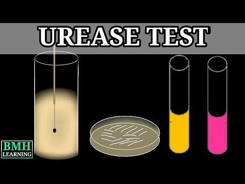 Urease Test