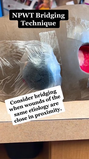 #woundvac #wocnlife #nursesoftiktok #fyp #trending #redhotchilipeppers #woundcare #music #foryoupage