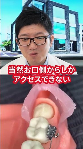 The dentist explains the wisdom tooth extraction process! [Yoshioka Dental Clinic]