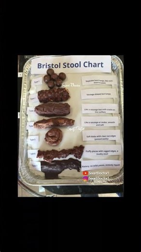 Types of Stool #healthylifestyle