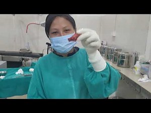 Open Appendectomy,a common surgical procedure ‪@resygoyari3205‬