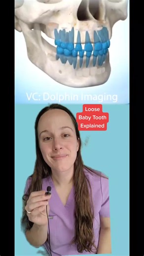 Understanding Why Baby Teeth Get Loose