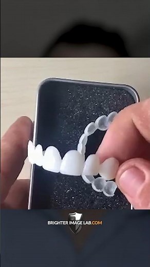 Brighter Image Lab Honest Snap-on Veneer Review!