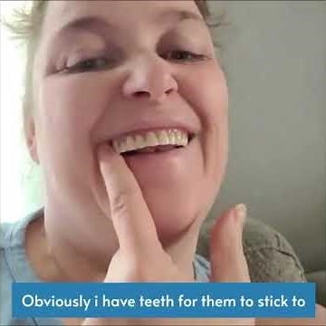 😁 My Results are Amazing 👌 Instant Smile Teeth Veneers 2025 👍
