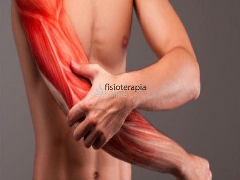 mialgia o dolor muscular