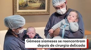 Gêmeos siameses se reencontram depois de cirurgia delicada