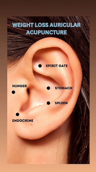 Dr. Aadil Khan on Instagram: "Recent research shows that acupuncture may help with weight loss. One study compared the effectiveness of auricular (ear) acupuncture to body acupuncture in obese women and found that those who received auricular acupuncture lost more weight—approximately 8 pounds more—than those who received acupuncture on other parts of the body. Do these points along with a good lifestyle and physical activity . Disclaimer: This content is for educational purposes only and is not