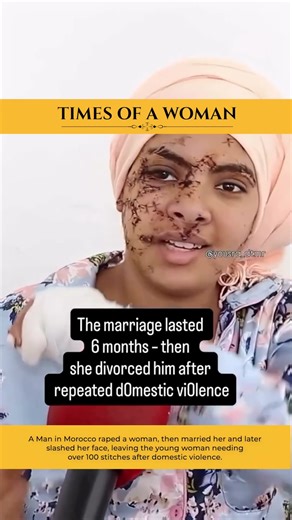 A Man in Morocco raped a woman, then married her and later slashed her face, leaving 100 stitches.