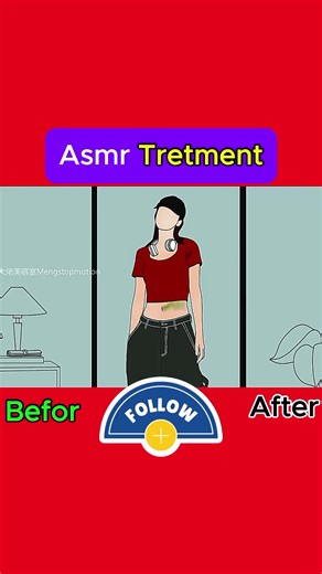 Deep Belly Button Cleaning ASMR: Before & After ✨ #ASMR #Satisfying #BellyButtonCleaning #NavelCare #OddlySatisfying
