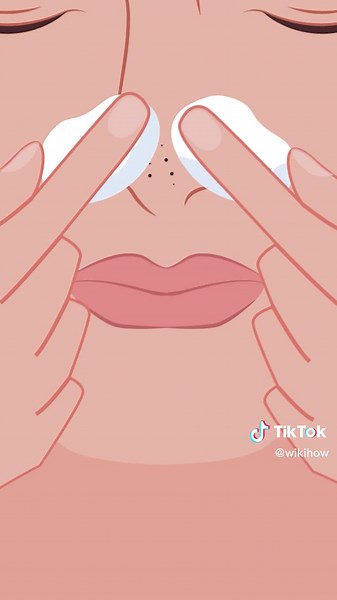 Best Way to Remove Stubborn Blackheads at Home