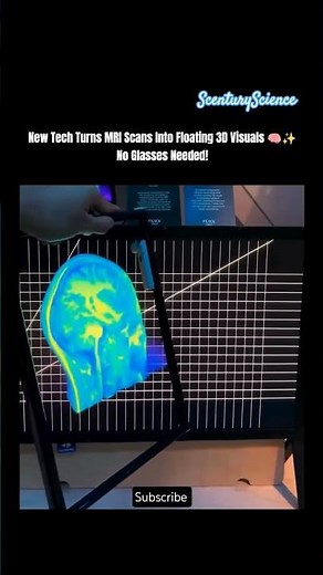 New Tech Turns MRI Scans Into Floating 3D Visuals 🧠✨No Glasses Needed! #science #medical