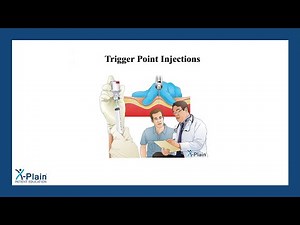 Trigger Point Injections