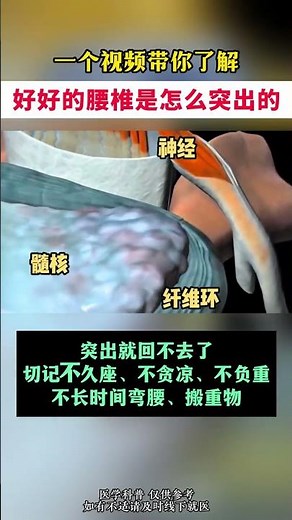 Lumbar Disc Protrusion: What Causes It & How to Fix It