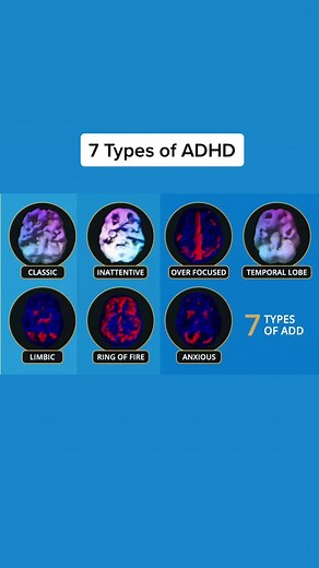 Brain imaging reveals there are 7 types of #ADHD. Brain imaging shows that ADD/ADHD is not a single or simple disorder. In fact, there are 7 types of brain patterns associated with the condition. Each type needs a distinctive treatment. Knowing your type, or your child’s type is the key to getting the most effective treatment. The 7 types of ADD are: Type 1: Classic ADD Type 2: Inattentive ADD Type 3: Overfocused ADD Type 4: Temporal Lobe ADD Type 5: Limbic ADD Type 6: Ring of Fire ADD Type 7: A