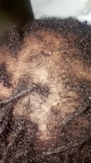 The Relaxing Art of Gum Chewing ASMR