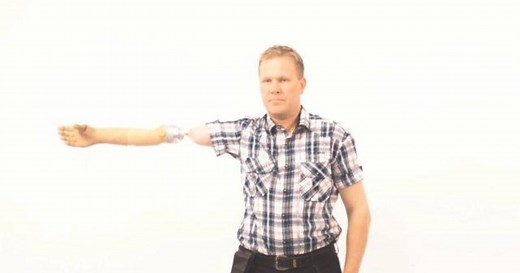 Prosthetic arm mimics natural movement