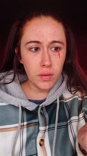 Trypophobia Trigger ⚠️ | SFX Makeup Transformation