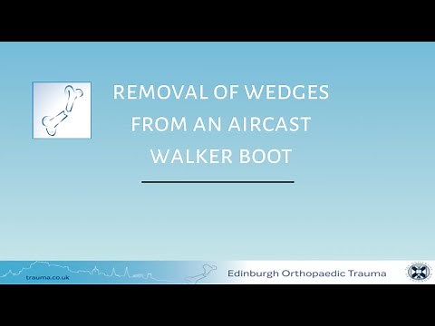Aircast boot wedge removal during treatment of an achilles tendon tear