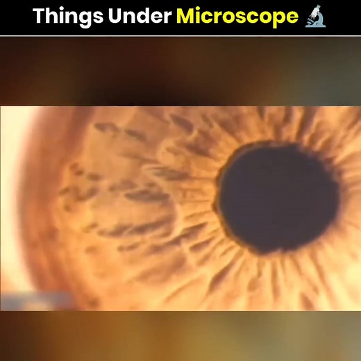Things Under Microscope 🔬 #microscope #MicroscopeMagic #MicroscopeDentistry #goal2025 #MicroscopeAdventures #popular #MicroscopeMoments #viewers #newfacts #viralreels #viral #reelsvideoシ #fact #viralreelsfb #shorts #newfacebookpost #ViralFacts2025 #ViralFactsHindi #viralfactsindia | The fact