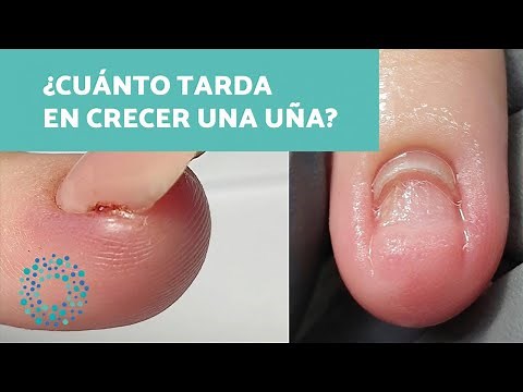 ¿Cuánto TARDA en crecer una UÑA del PIE? - Tips y soluciones