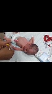 How to Pass IV Line newborn baby & Medication Management | Complete NICU Nurse Education Video #viral #newborn #baby #trending #anencephaly #babycare | Anoop Gautam