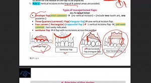 periodontal flaps 2.avi