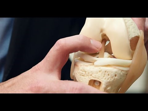 How to Identify and Treat an ACL Tear