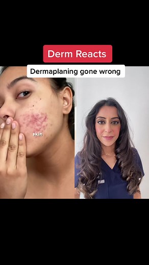 Dermaplaning Gone Wrong: Causes, Risks, and Treatment
