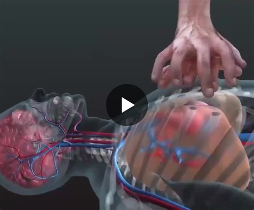 #healthcare #leadership #cpr #lifesaving #resilience #medicaleducation #growth #mindset #purpose #emergencycare | Bruce Shapiro | 12 comments