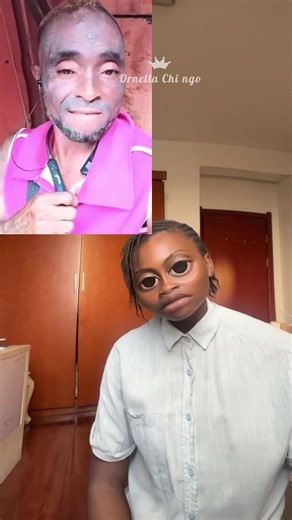 Partie 28| pendant que je parle tu t’abonnes 🥰✌🏽#ornellachi #dépigmentation #bleaching #gluelesswig #humourtiktok