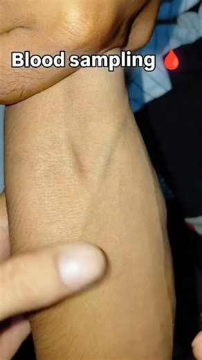 𝐵𝓈𝒸 𝓃𝓊𝓇𝓈𝒾𝓃𝑔 𝓈𝓉𝓊𝒹𝑒𝓃𝓉 on Instagram: "#likexommentshare🔥❤️🥀💥____"