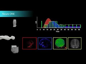 Complete Brain Perfusion Imaging in Just One Minute