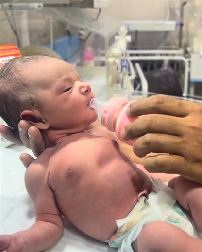 11K views · 273 reactions | this video, we explain how to take...