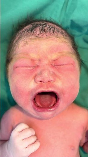 👶✨ Emotional Newborn Baby Cry 😭 | Hospital Moments #shorts #viral #youtubeshorts #cute #baby