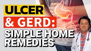16K views · 204 reactions | Ulcer and GERD: Simple Home Remedies By Doctor Willie Ong (Internist and Cardiologist) Ulcer and GERD are conditions of the stomach. Watch this video to look for home remedies that can help you ease the pain of these diseases. | Health Guide by Dr Willie Ong | Facebook