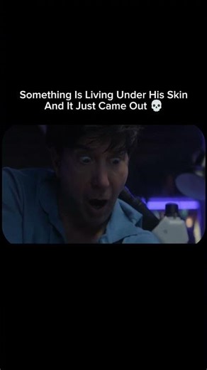 ​IT CAME OUT! 😱 Parasite under his skin! #BodyHorror #Scary #Parasite