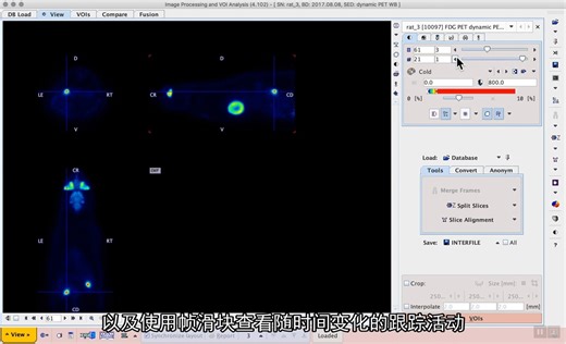 医学图像处理和分析软件 PMod（S1E5）：Dynamic images and capturing tracer kinetics