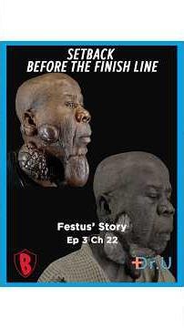 The Final Chapter of Festus' Severe Keloids Journey