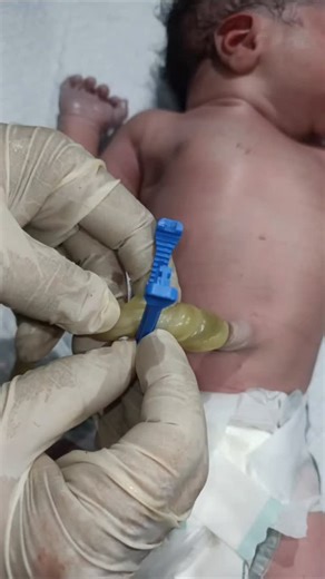 Surg Tech.AbdulRahman on Instagram